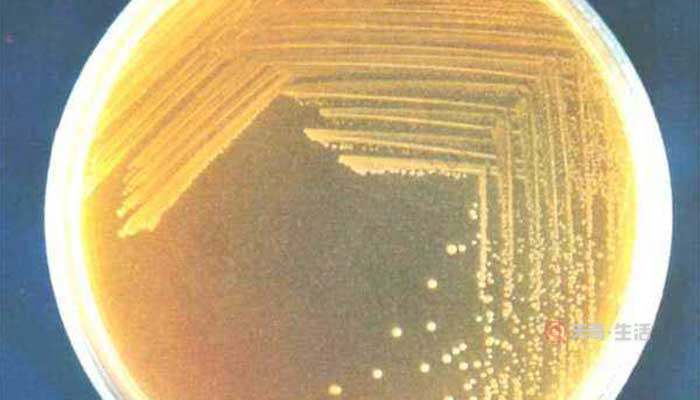 What is the difference between bacterial colonies and fungal colonies? How to distinguish bacterial colonies and fungal colonies?(图2) What is the difference between bacterial colonies and fungal colonies